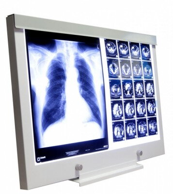 Negatoskop LED NGP-21 SLIM, 2 panelový stolový