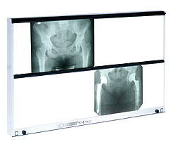 Negatoskop NGP-1000 HF (bez úpravy jasu)